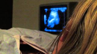 IVF diary  9  IVF the secret cycle  Embryo Transfer IVF [upl. by Anasxor176]