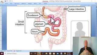 Intestinal disorders in Arabic 1  Intestinal Obstruction in general  part 1   by Dr Wahdan [upl. by Ainitsirhc898]