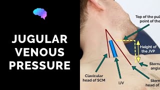 Measuring Jugular Venous Pressure JVP  OSCE Guide Clip  UKMLA  CPSA [upl. by Innis356]