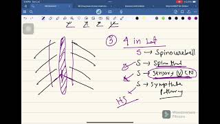 Medullary Syndrome Neurology04 FCPS Part01 Batch Whats App 01878342090 [upl. by Ahsoik333]