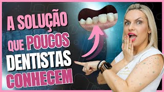 Como Fazer Faceta em Resina em Dente Escurecido  A Solução Que Vai te Surpreender facetasderesina [upl. by Ahpla]