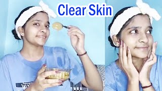 How to Remove Dark Patches on Face  How to Remove Dark Spots Caused by Pimples or Hyperpigmentation [upl. by Melc]