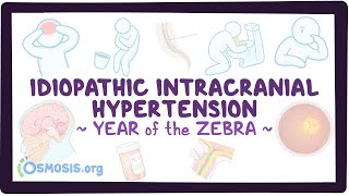 Idiopathic intracranial hypertension Year of the Zebra [upl. by Arabel]