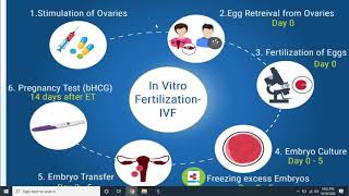 What is the process of IVF  Dr Paulami Dey  IVF specialist  Nova IVF Raipur [upl. by Etnovert]