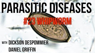 Parasitic Diseases Lectures 23 Whipworm [upl. by Adnilahs221]