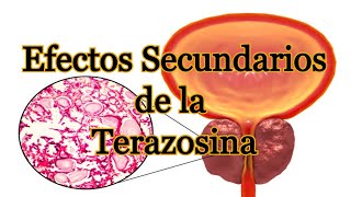 Efectos Secundarios de la Terazosina [upl. by Vinaya]