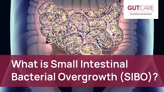 What is Small Intestinal Bacterial Overgrowth SIBO  GUTCARE [upl. by Ical]