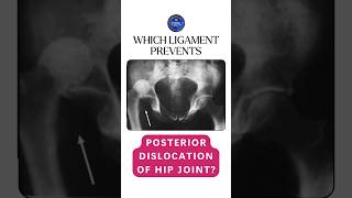 Which ligament prevents the posterior dislocation of hip joint shorts hipjoint ligaments [upl. by Airetnohs93]