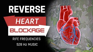 Heart Blockage Reversal  Remove Heart Blockage Naturally  RIFE Frequencies  528 Hz Music MF148 [upl. by Edmond787]