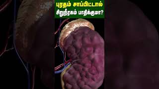 புரதம் சாப்பிட்டால் சிறுநீரகம் பாதிக்குமா  Does eating protein affect the kidney  Dr Arunkumar [upl. by Arleta]