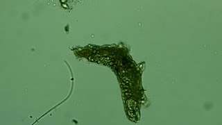 Water Bear  Tardigrades  Microscope Fun [upl. by Ednew]