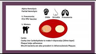 Quels sont les causes du RAA  ASLO Cardite Sydenham Angine Rhumatisme Articulaire Aigu 3 Minutes [upl. by Lot]