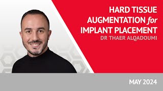 Hard Tissue Augmentation for Implant Placement with Dr Thaer Alqadoumi [upl. by Tessler113]