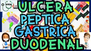 ÚLCERA PÉPTICA GÁSTRICA Y DUODENAL  GuiaMed [upl. by Imogene]