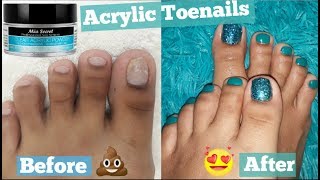 FOOT TRANSFORMATION How I extend my short Toenails using Acrylic without TIP   PEDICURE at Home [upl. by Callida689]