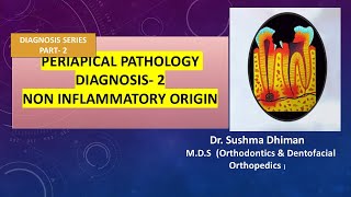 Periapical Pathology  Non inflammatory and non odontogenic lesions [upl. by Ahtamas]