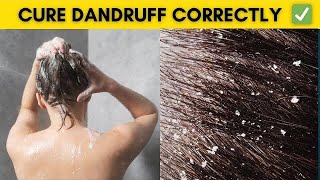 How to treat dandruff and itchy scalp at home [upl. by Adamo247]