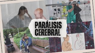 Parálisis cerebral [upl. by Koah]