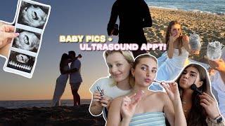 taking pregnancygender reveal pics first ultrasound  qampa [upl. by Anairo]