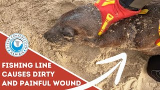 Fishing Line Causes Dirty And Painful Wound [upl. by Ahsata]