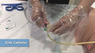 Care of Urinary Catheter  Change of Urine Bag [upl. by Holden]