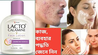 Lacto Calamine face lotion use  Review in Bengali [upl. by Eciuqram]