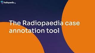 Annotating Radiopaedia cases [upl. by Cone835]