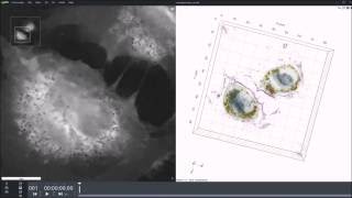 Gold nanoparticles internalized by HUVEC cells [upl. by Parik524]