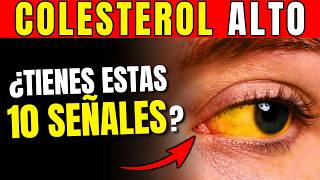 10 Señales de ALERTA si tienes COLESTEROL ALTO  SÍNTOMAS INICIALES [upl. by Assenar260]