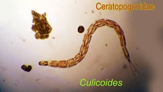 CULICOIDES larvae [upl. by Yra]