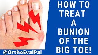 Bunions  Hallux Valgus Diagnosis Exercises Treatment [upl. by Gayler954]