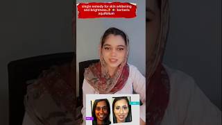 Best Remedy For Skin Whitening  Berberis Aquifolium Ka Tarika  Skin Whitening Tips shorts [upl. by Lamaaj]