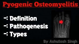 OSTEOMYELITIS Pathology [upl. by Norramic]