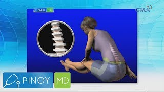 Pinoy MD​ Solusyon sa lower back pain alamin [upl. by Colley]