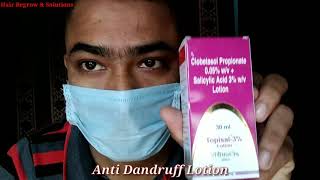 Anti Dandruff Lotion  Topisal 3 Lotion  How to Apply Topisal Lotion for best results 87Rs only [upl. by Ecnahc]