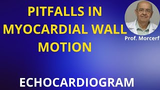 Tips for Better LV Endocardial Identification [upl. by Alor]