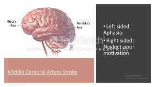 Syphilis neurosyphilis [upl. by Song]