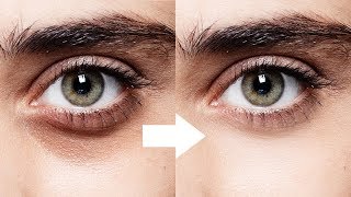 1Minute Photoshop  Remove Dark Circles Naturally [upl. by Arykat]