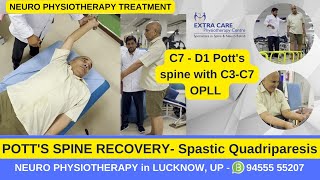 Potts Spine Physiotherapy Rehab  Best Exercises for Potts Spine  TB of Spine  Extra Care Lko [upl. by Llemaj72]