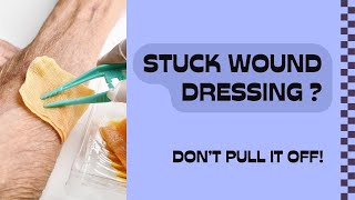 Never Pull Off Stuck Wound Dressing do this instead [upl. by Jedidiah]