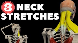 Neck Stretches for Instant pain relief [upl. by Domonic]