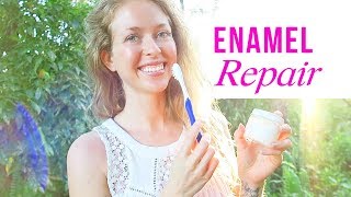 How I Naturally Restored My Enamel and Remineralized My Teeth [upl. by Nurav]