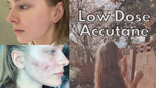 6 months post accutane results  LOW DOSE TREATMENT [upl. by Sikes475]