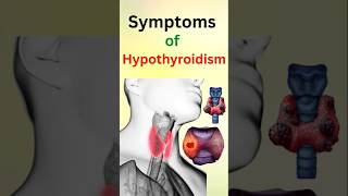 Symptoms of Hypothyoidism [upl. by Doreen745]