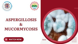 Aspergillosis amp Mucormycosis [upl. by Urba]