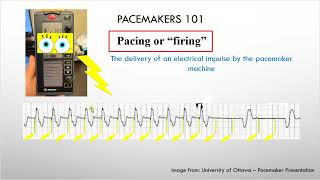 Cardiology  Temporary Cardiac Pacemakers Review for RNs RPNs amp Nursing Students [upl. by Kali]