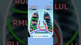 How to read chest Xrays [upl. by Airehc]