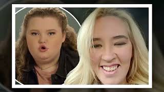 Heardbreaking newsFrom Mama June Aunt Doe Doe Begs For Prayers What Happened [upl. by Shiau629]