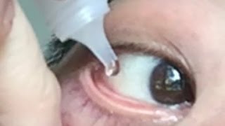 How to use eye drops properly How to put eyedrops in your own eyes [upl. by Regazzi293]