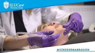 Microdermabrasion for Thick Pigmented and Sun Damaged Skin  SLUCare Cosmetic Dermatology [upl. by Garmaise]